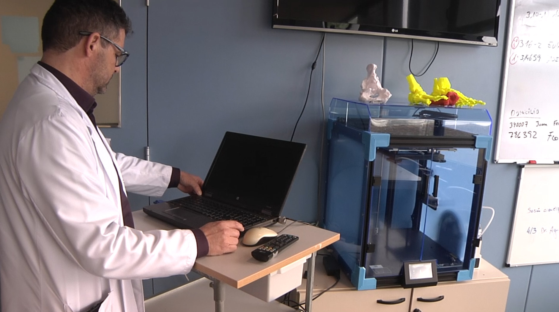 L’Hospital de Blanes aposta per la impressió 3D per fer precisions prequirúrgiques